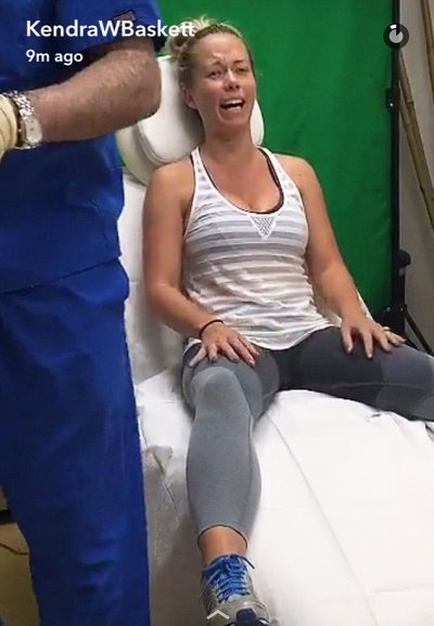 Kendra Wilkinson Snapchats Her First Botox Procedure 5926